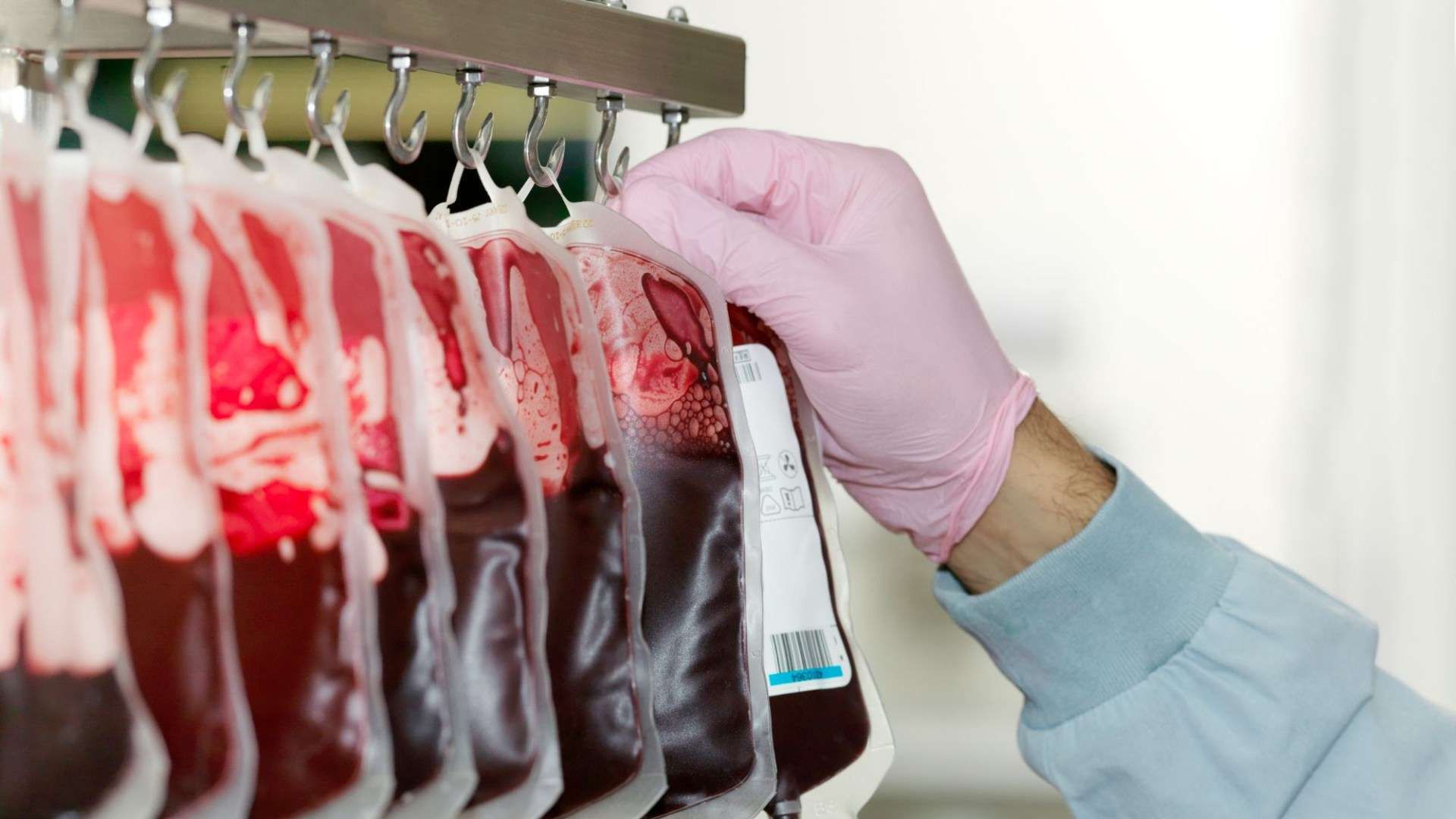 NHS blood contamination scandal: How many infected with Hepatitis C and HIV after transfusions and how many died?