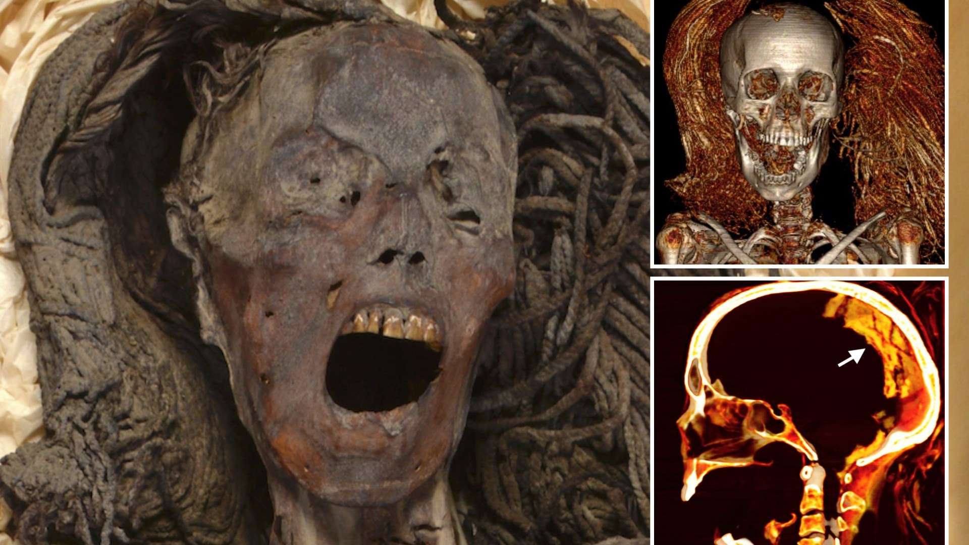 Bone-chilling mystery of Egyptian mummy’s twisted face frozen in a SCREAM is finally solved by scientists Bone-chilling mystery of Egyptian mummy’s twisted face frozen in a SCREAM is finally solved by scientists