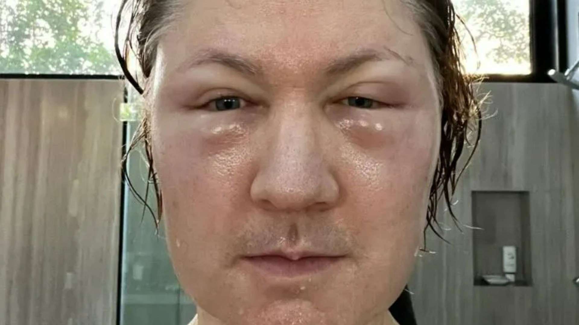 Famous tech billionaire, 47, is unrecognisable after controversial FAT injections – do you know who it is? Famous tech billionaire, 47, is unrecognisable after controversial FAT injections – do you know who it is?